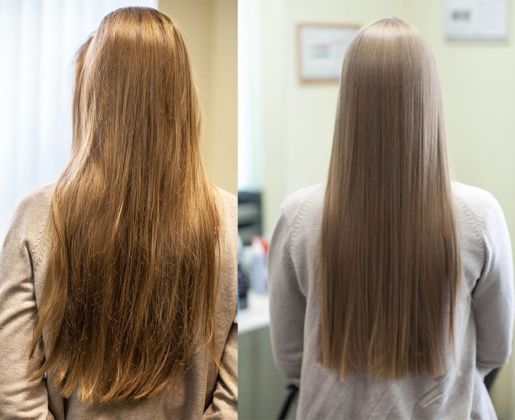 Resultado biolaminirovanie-volos_2